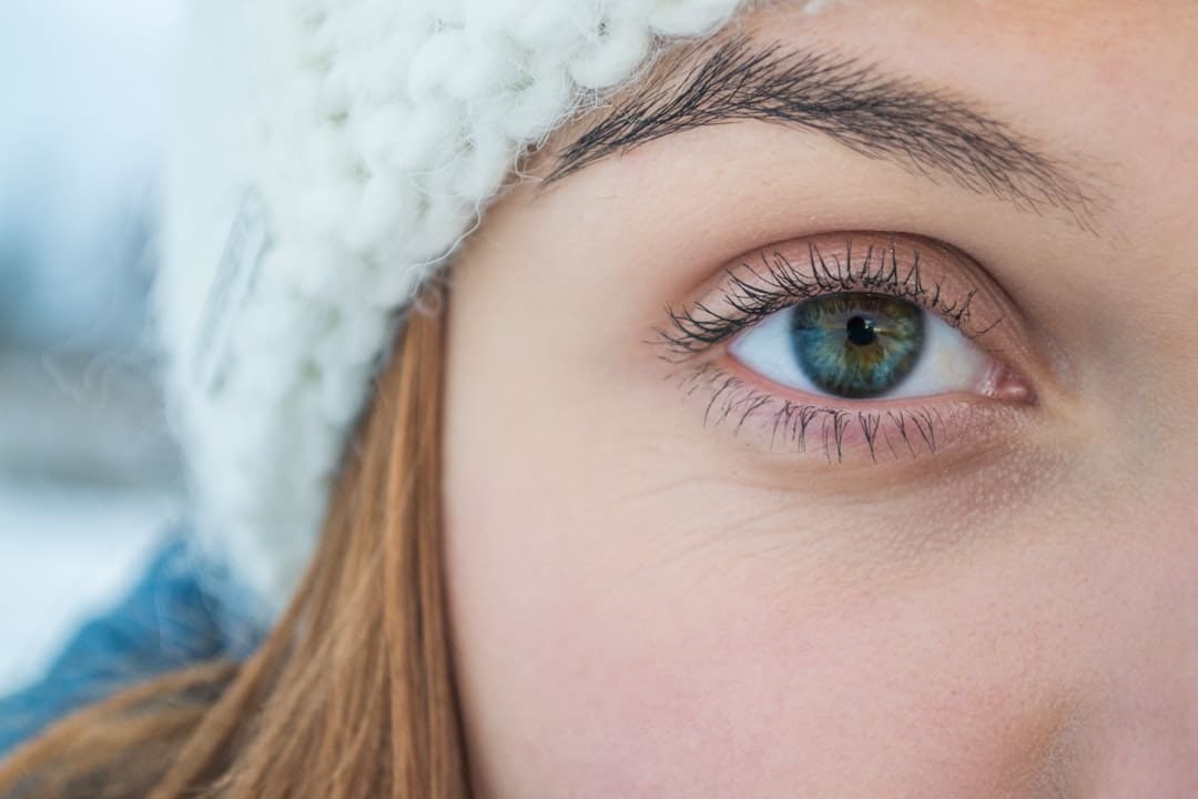 Dry Eyes from Contacts: Causes and Solutions
